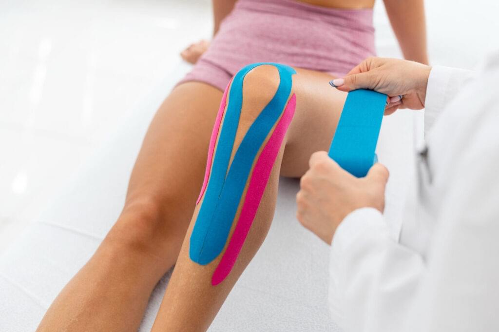 hondromalacija patele - primjena kinesio tapinga