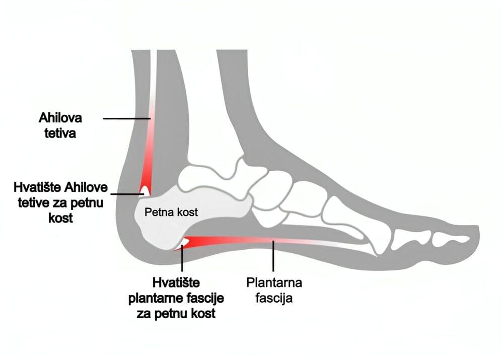 Bol u peti_građa (anatomija) stopala