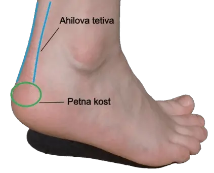 Ahilova tetiva_prikaz stopala, površinska anatomija