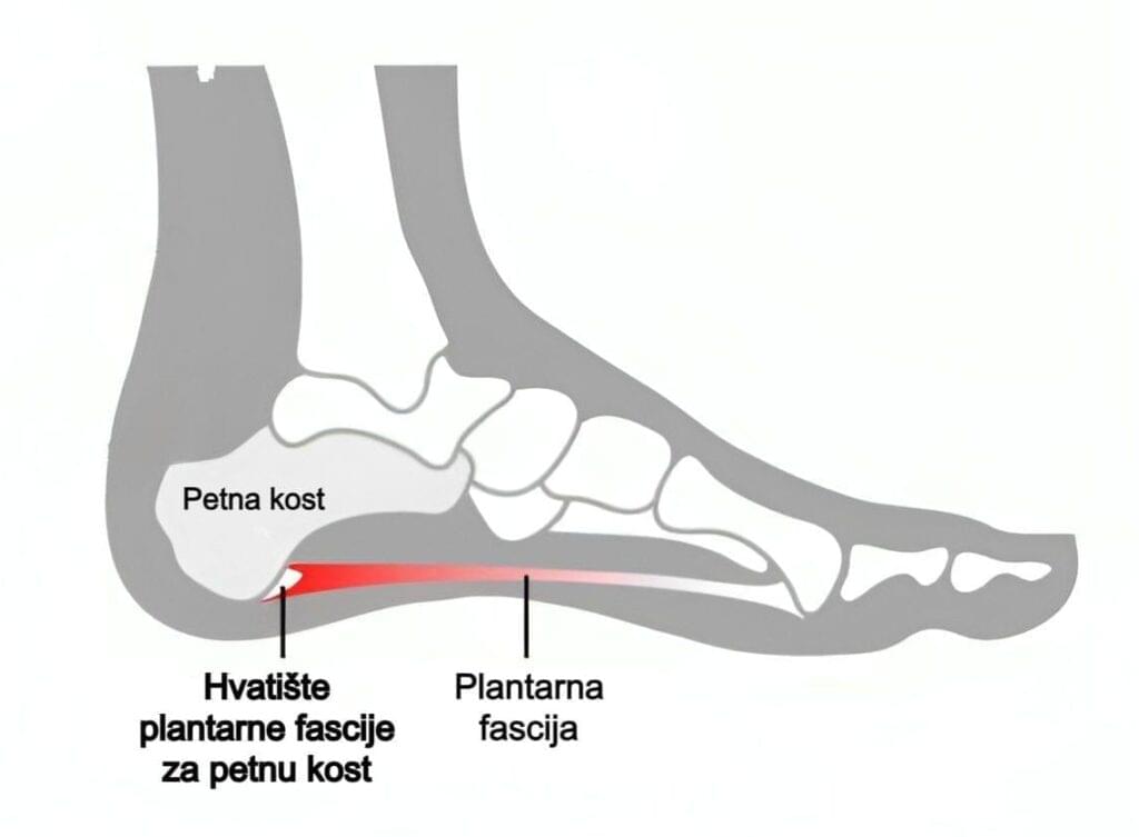 Plantarna fascija_ građa, anatomija stopala