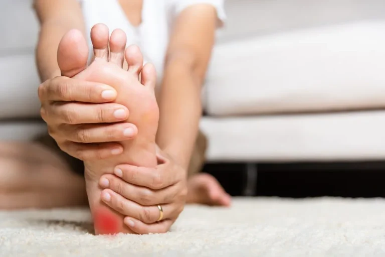 Plantarni fascitis – žena se drži za bolno područje pete