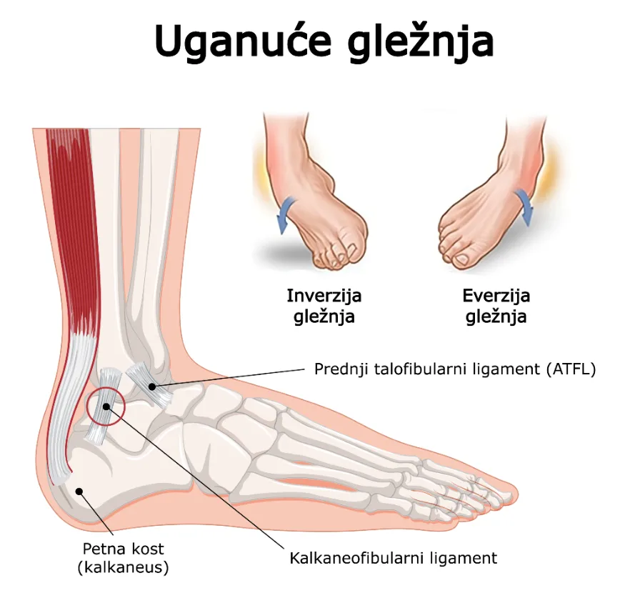 Uganuće gležnja – prikaz glavnih ligamenata (prednji talofibularni ligament i kalkaneofibularni ligament), inverzija i everzija stopala