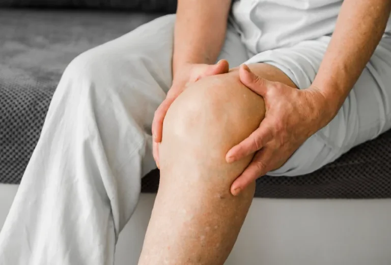 Voda u koljenu – otečeno koljeno s vidljivom oteklinom i nakupljanjem tekućine u zglobu, prikaz simptoma i upale koljena.